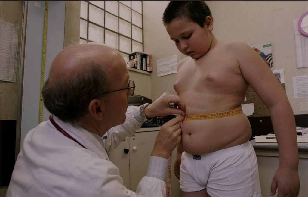 Расстройство пищевого поведения Мальчик с ожирением
